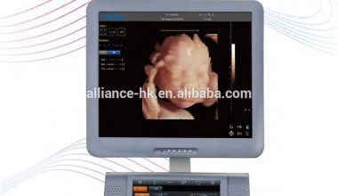 CHISON  I6