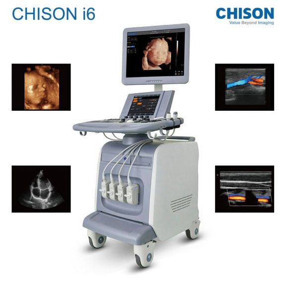 CHISON  I6 2